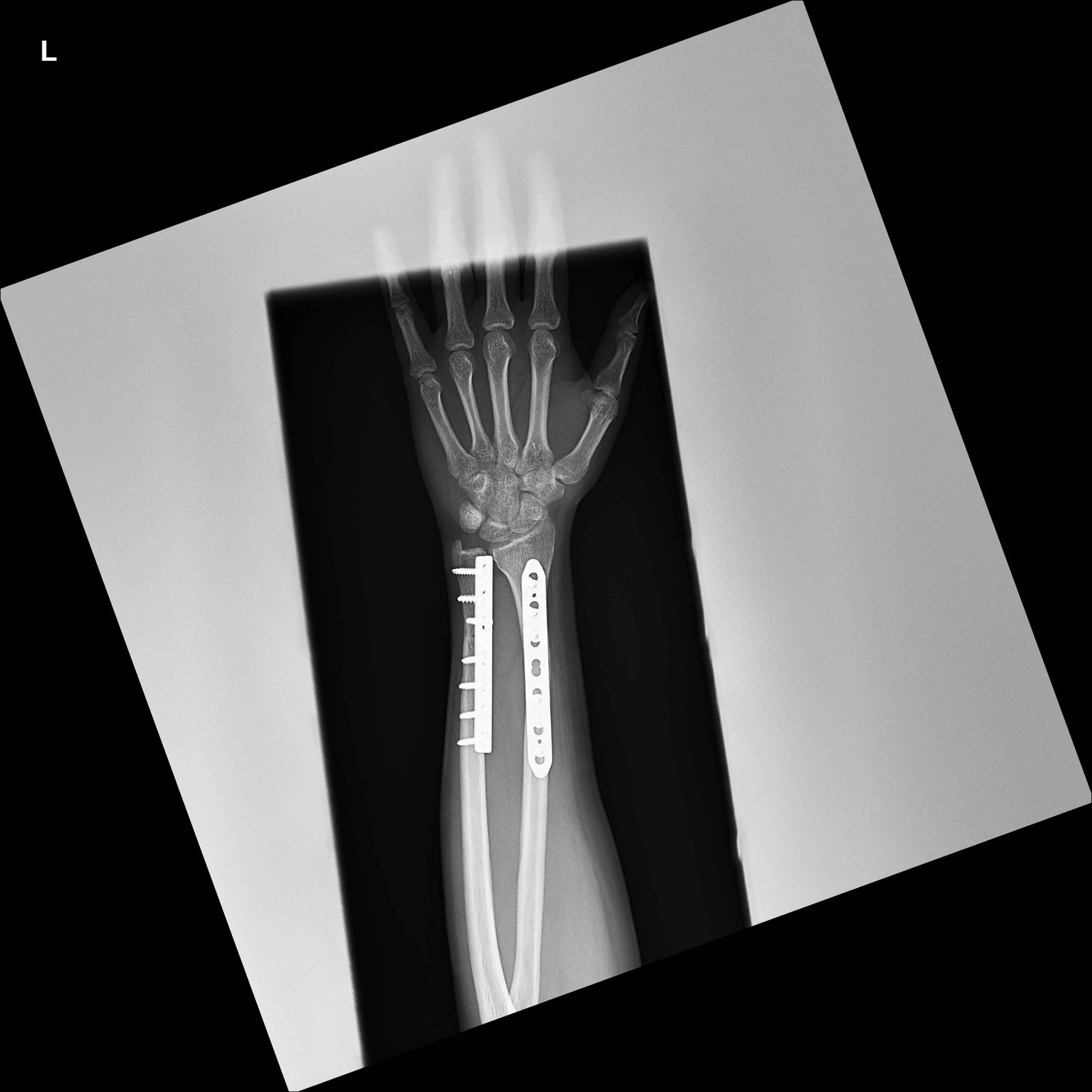 Slider Image 5
