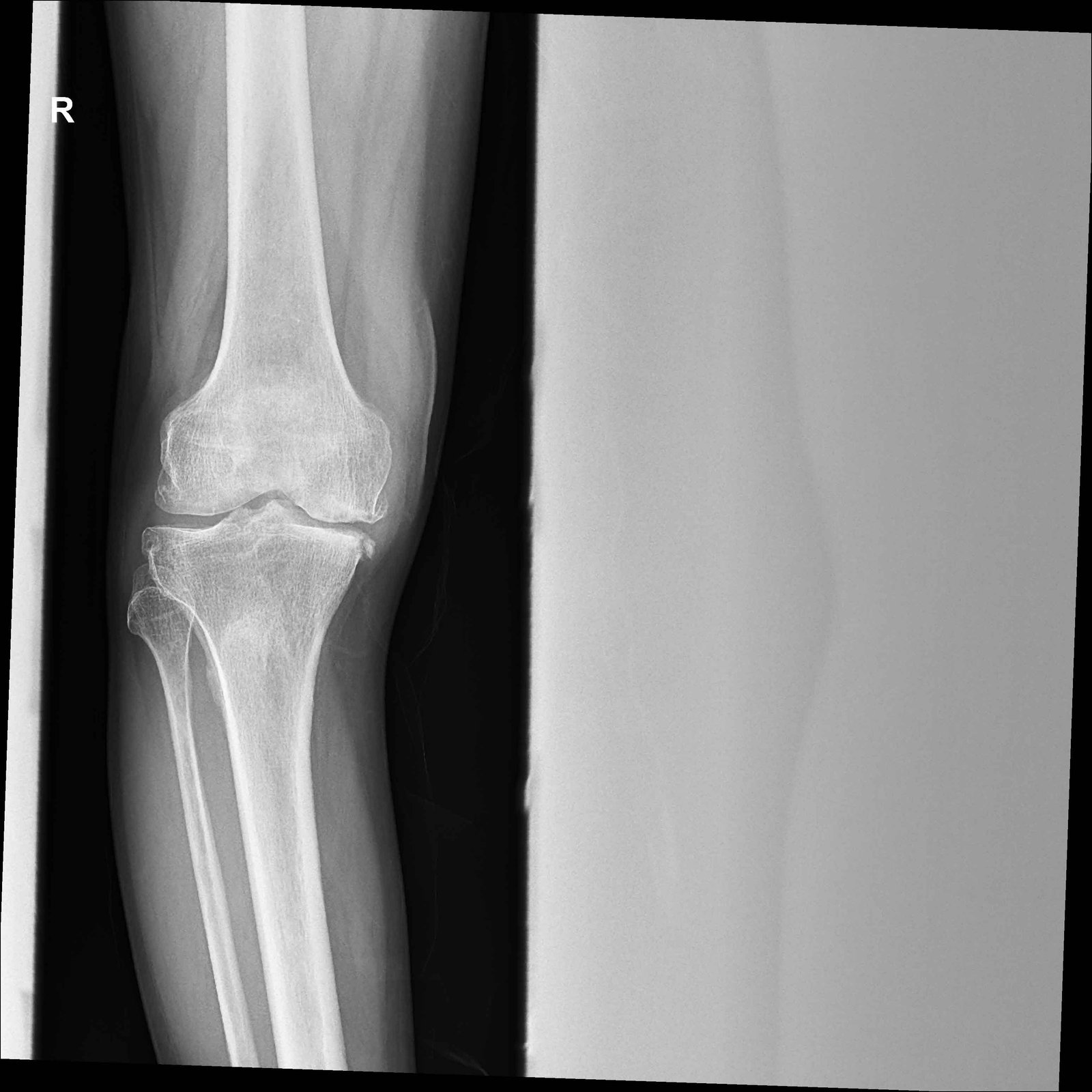 Slider Image 5