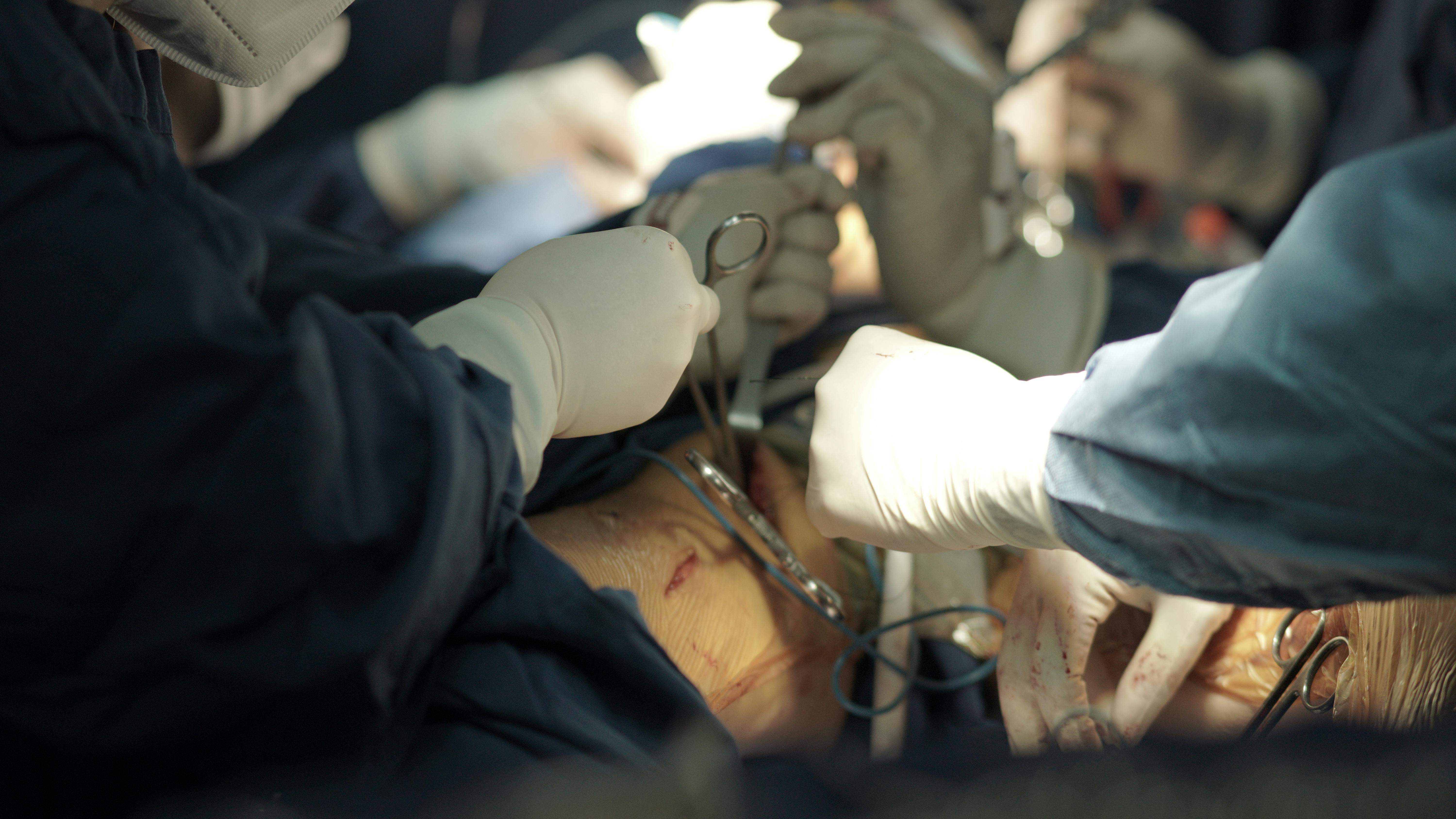 BoneTumourSurgery