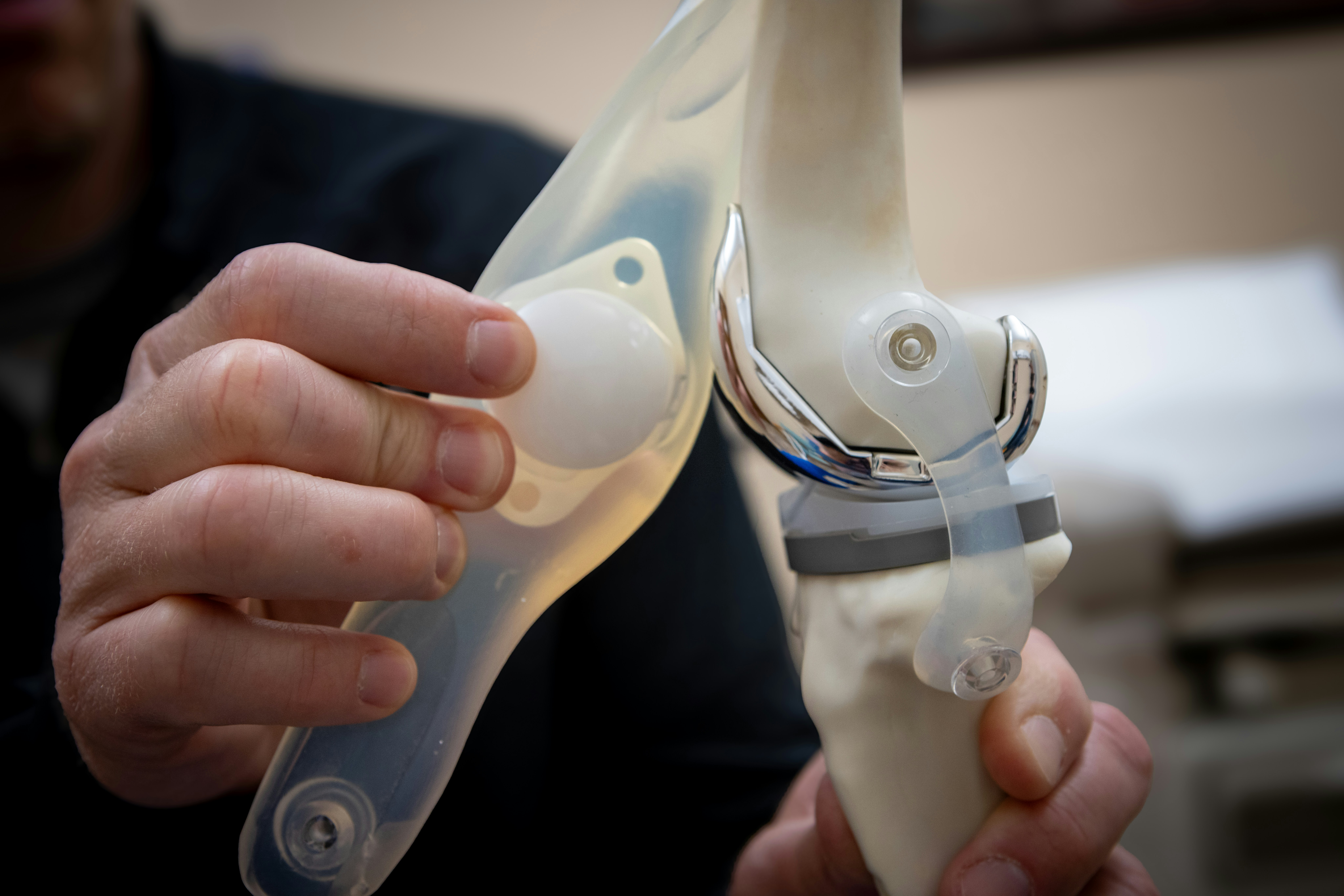 KneeReplacement