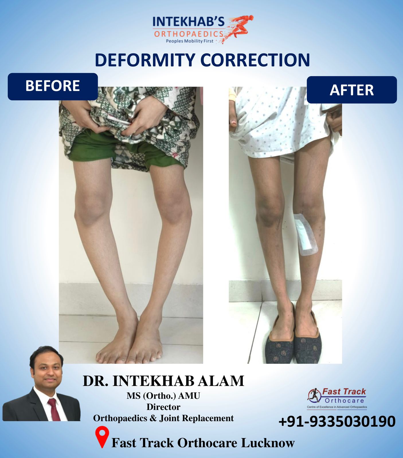 JointReplacementSurgery